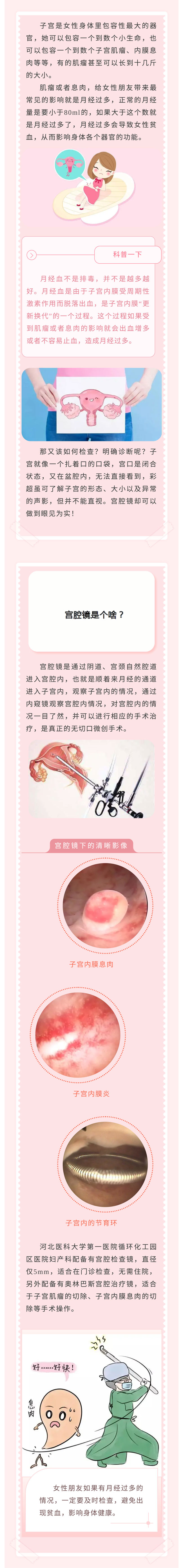 月经量增多！怎么回事？——小小“宫腔镜”，一探究竟！.jpg